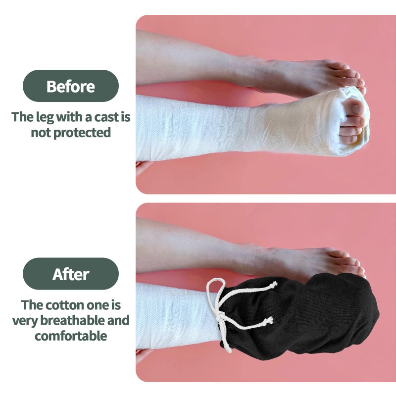 OXDFK Cast Sock Cover for Foot, Cast Cover for Foot, Leg Cast Cover, Adjustable Drawstring Foot Cast Cover for Men and Women(Black) - Image 4
